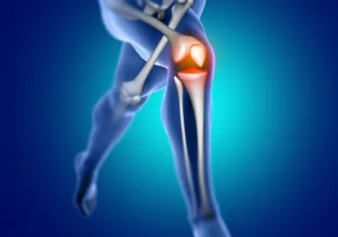 Resonancia magnética de rodilla: diagnóstico de lesiones