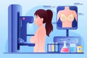 importancia de la mamografía