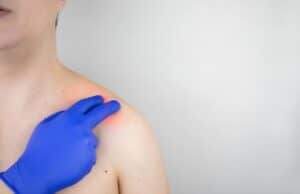 Tendinitis en el hombro