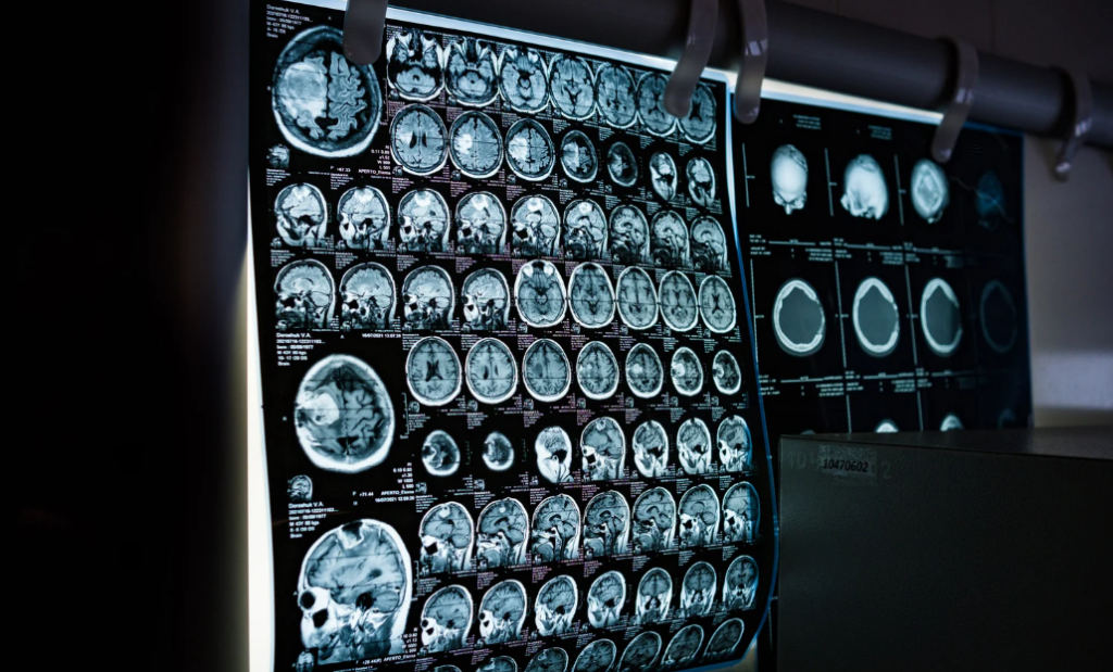 Radiografía vs resonancia: ¿Qué examen necesitas según tus síntomas?