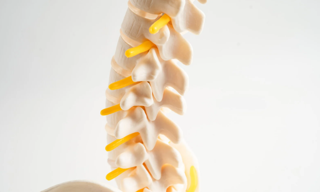 Resonancia magnética de columna lumbar: mitos y realidades