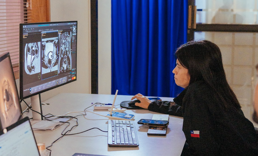 Beneficios de la resonancia magnética cráneo encefálica bilateral